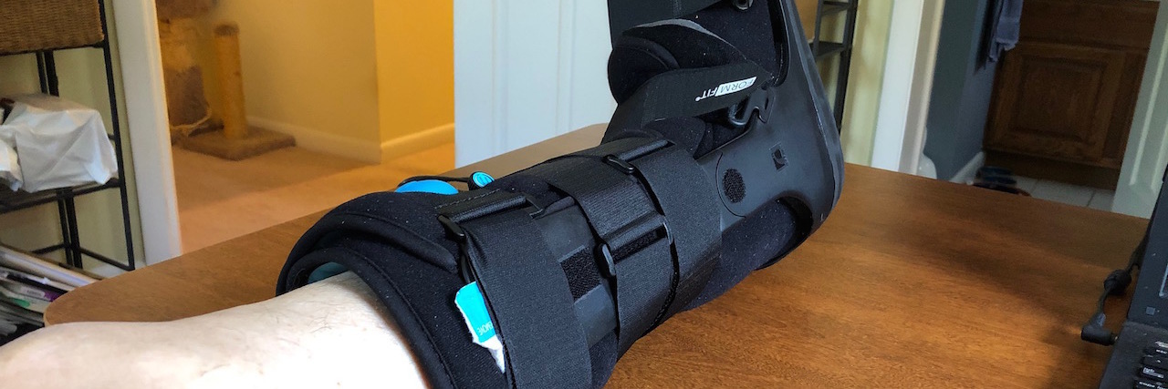 How to Cope With an Injury When You Have Parkinson's Disease Man's foot in a cast, propped up on a table