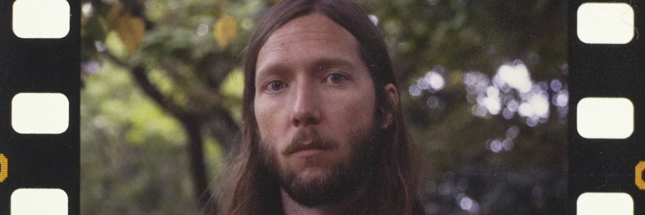 The Sheepdogs' Sam Corbett Opens Up About His Cancer Diagnosis sam corbett