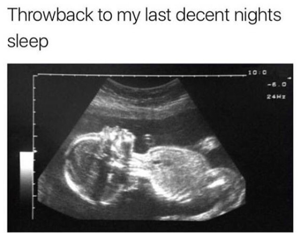 Throwback to my last decent nights sleep (image of a sonogram below text)