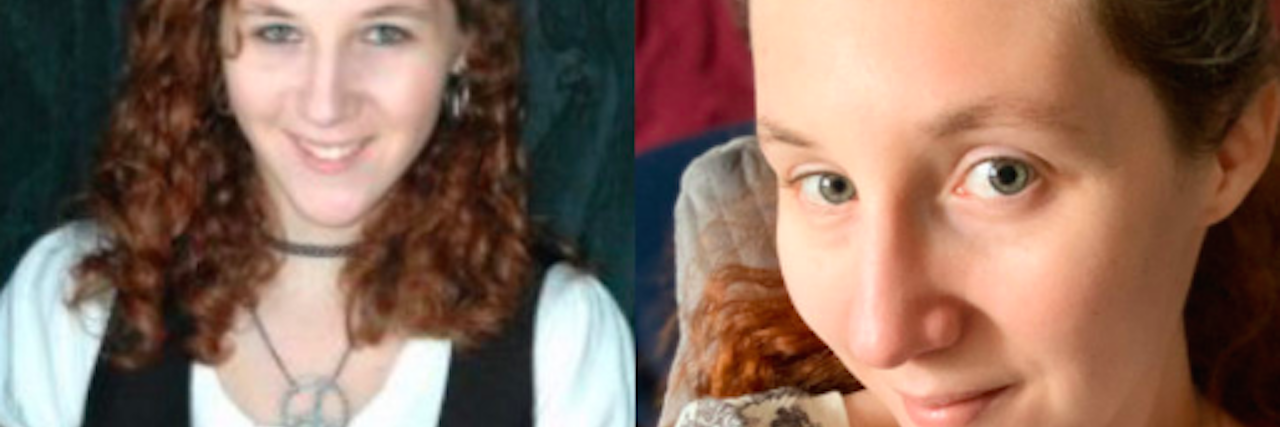 The 10-Year Photo Challenge When You're Sick