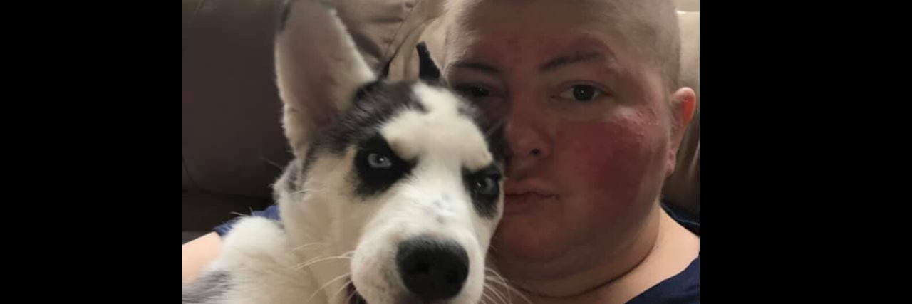 The Most Difficult Question I'm Asked as a Chronically Ill Woman a woman is cuddling her dog