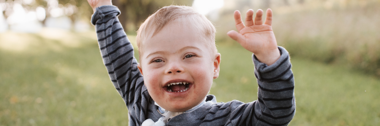 Yes, Using the R-Word Is Harmful Amber's son AJ, who has Down syndrome and a tracheostomy, laughing outdoors.