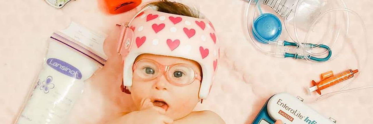 How to Talk About Disabilities With Your Kids Ivy, a baby with Down syndrome surrounded by her tube feeding supplies.