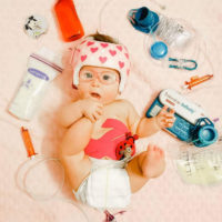 Ivy, a baby with Down syndrome surrounded by her tube feeding supplies.