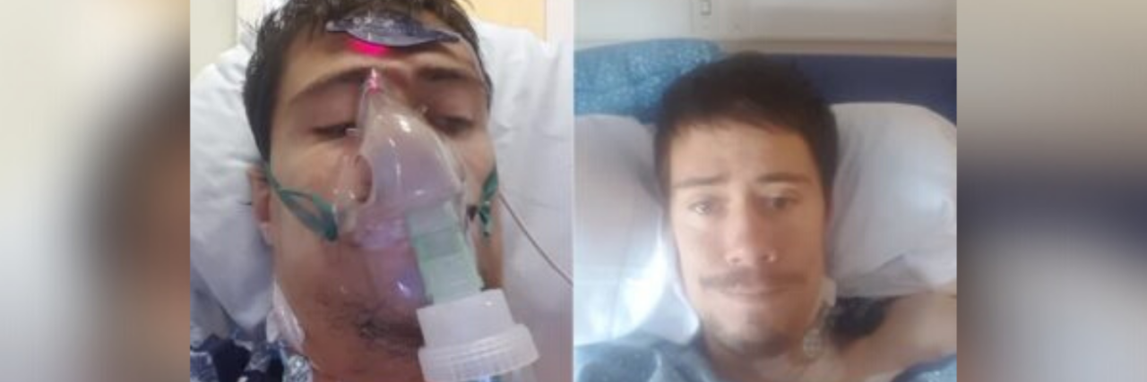 How Fighting Sepsis and Fournier's Gangrene Affected My Mental Health side by side pictures of author in a hospital bed. Left picture intubated, right picture soft smile without tubes