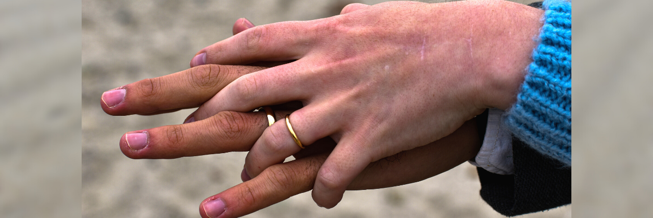 My Husband Helps Me Fight Against the Loneliness of Chronic Illness Two hands holding one another