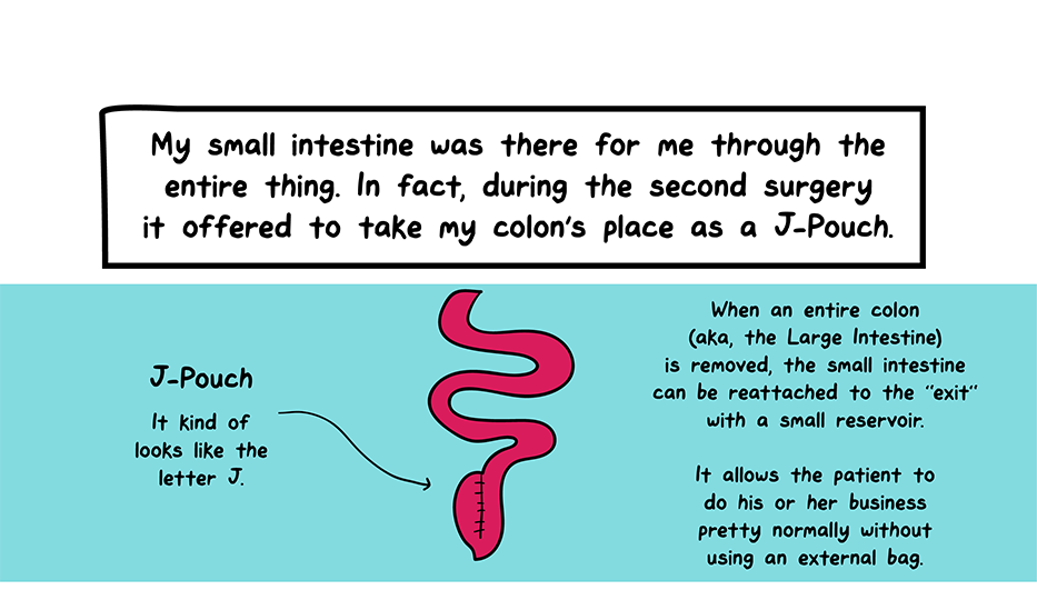 How I Broke Up With My Colon comic: My small intestine was there for me through the entire thing. In fact, during the second surgery it offered to take my colon's place as a J-pouch. (Illustration shows what a J pouch looks like and its purpose as an alternate to the colon instead of an external bag)