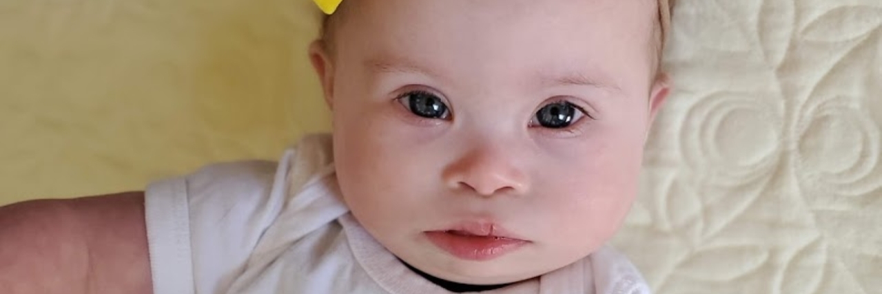 What 'Proving Them Wrong' About Down Syndrome Really Means Baby Ivy.