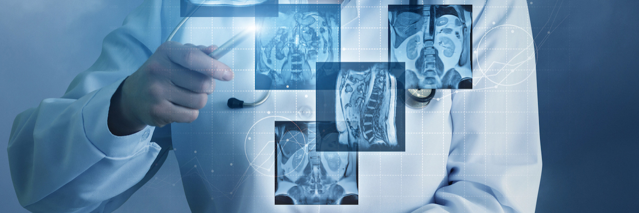 Why Unsecured Medical Images Are a Threat to Patients Doctor sees virtual images of the patient on a blue background.