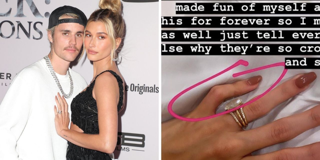 Hailey Baldwin Reveals Ectrodactyly Affects Her Pinky Fingers The Mighty