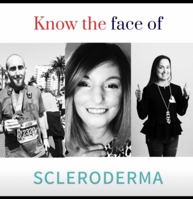 photo of author and two other people with the caption "know the face of scleroderma"