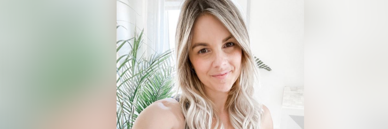 'Bachelorette' Ali Fedotowsky Reveals Photo of Skin Cancer ali fedotowsky
