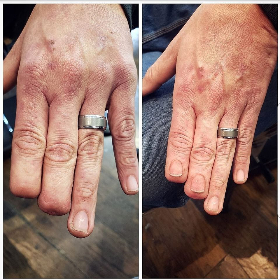 Mark Bertram lost the tips of two fingers in a construction accident last year. Bertram was trapped in a fan belt at work when the tips of his fingers were severed off. Eric Catalano tattooed fingernails for Bertram. (Courtesy of Eric Catalano)
