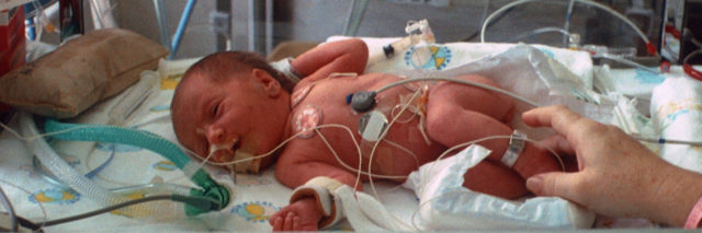 Newborn preemie in neonatal intensive care unit