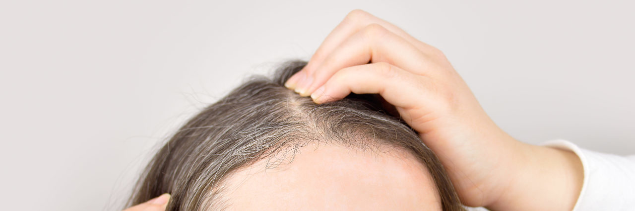 Aging With Osteogenesis Imperfecta Woman shows her gray hair