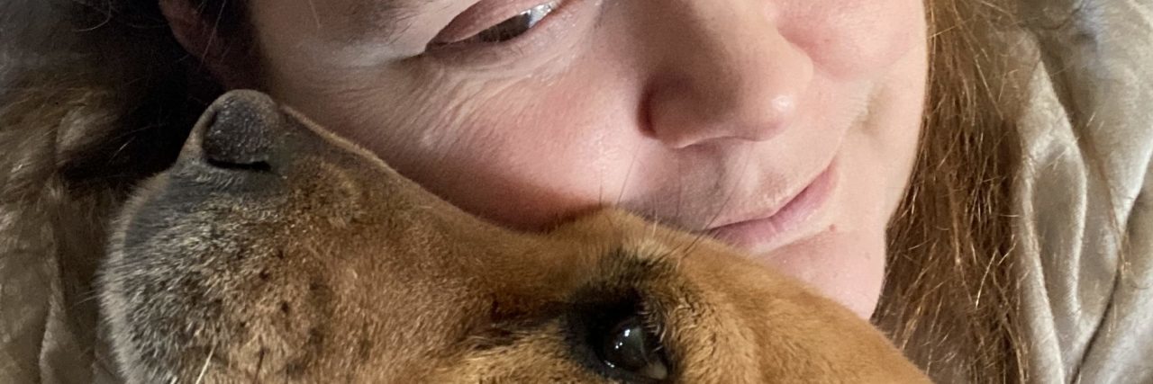 The Chronic Illness Exertion and Recovery Cycle