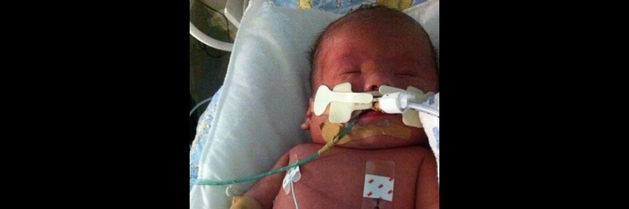 What Doctors Told Me About My Baby With Down Syndrome A baby boy in the NICU.