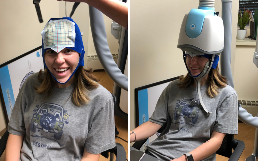 photos of woman smiling and wearing helmet for transcranial magnetic stimulation therapy