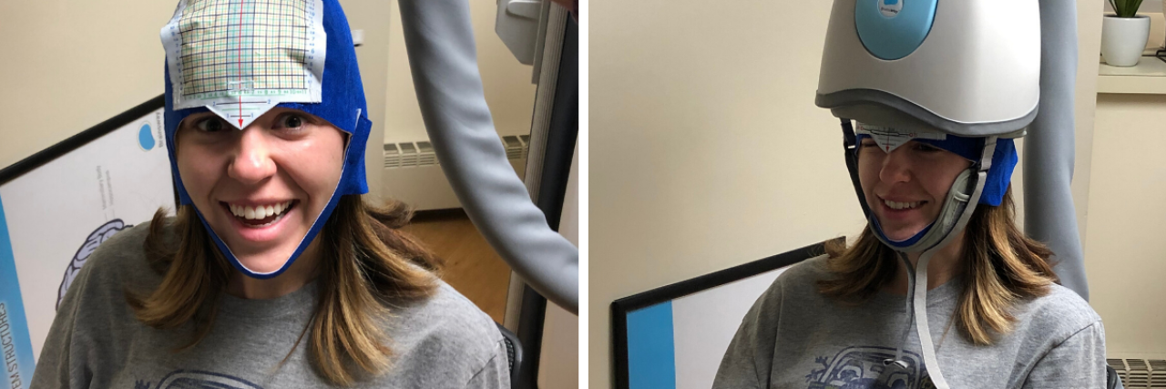 How Transcranial Magnetic Stimulation Therapy Reduced My Depression
