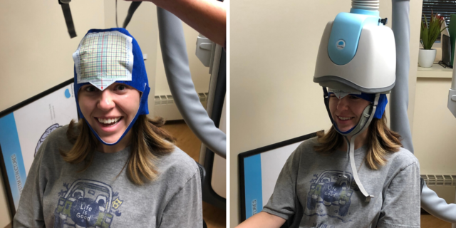 How 30 Days of Transcranial Magnetic Stimulation (TMS) Therapy Affected My Depression