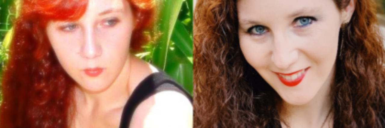 Eating Disorder Behaviors Gave Me Control Over My Chronic Illness Body two photos of a young woman with red hair, looking younger on the left and older on the right.