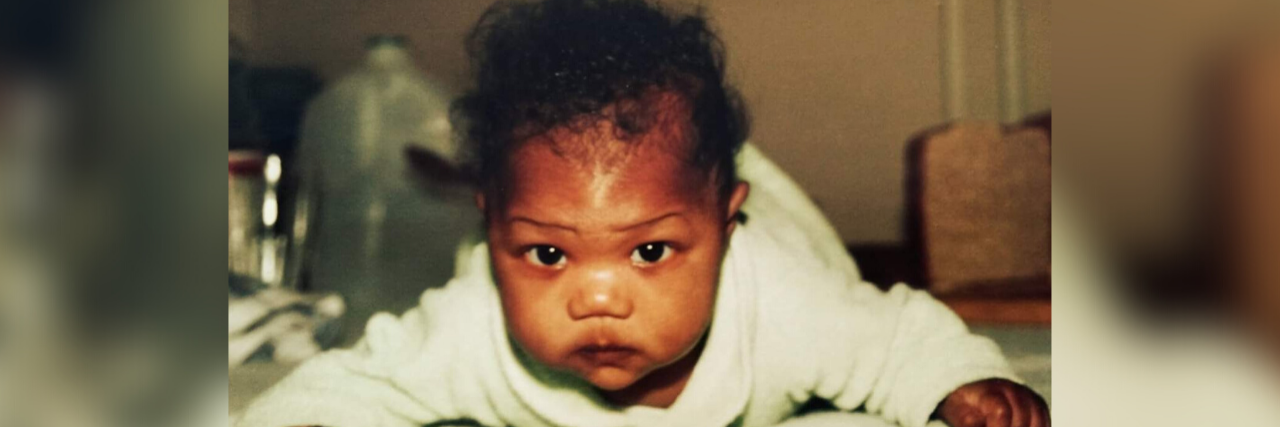 Healing From the Trauma of Transracial Adoption young baby doing tummy time and looking at the camera