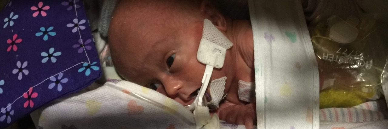 Wearing a Mask Protects Children at High Risk for COVID-19 Lily in the hospital shortly after her birth.