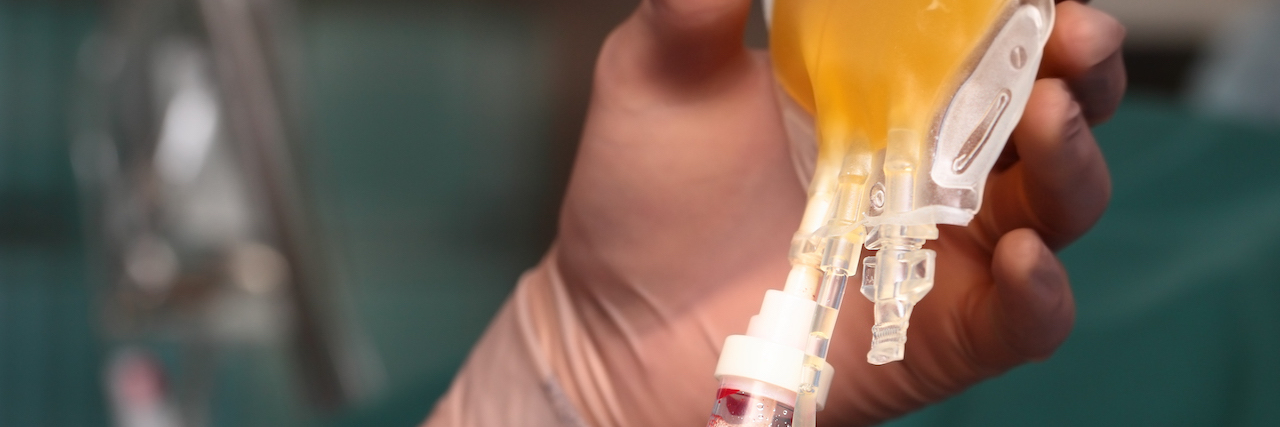 Convalescent Plasma Therapy May Help Treat COVID-19 Transfusion of human plasma.