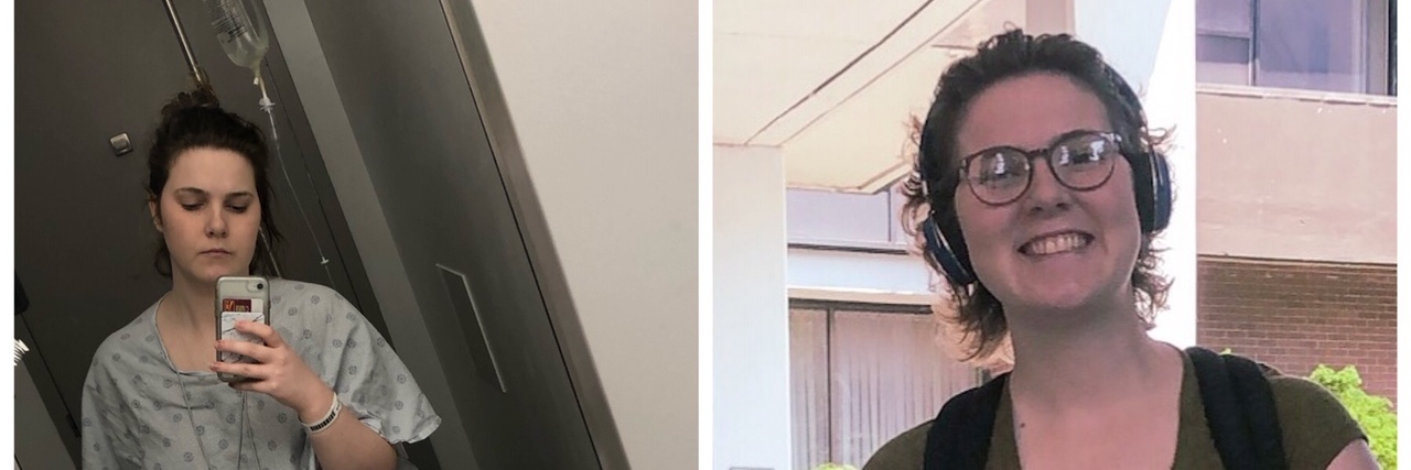 Pursuing a Social Work Degree With POTS Lola selfie on a bad day, and when out and about.