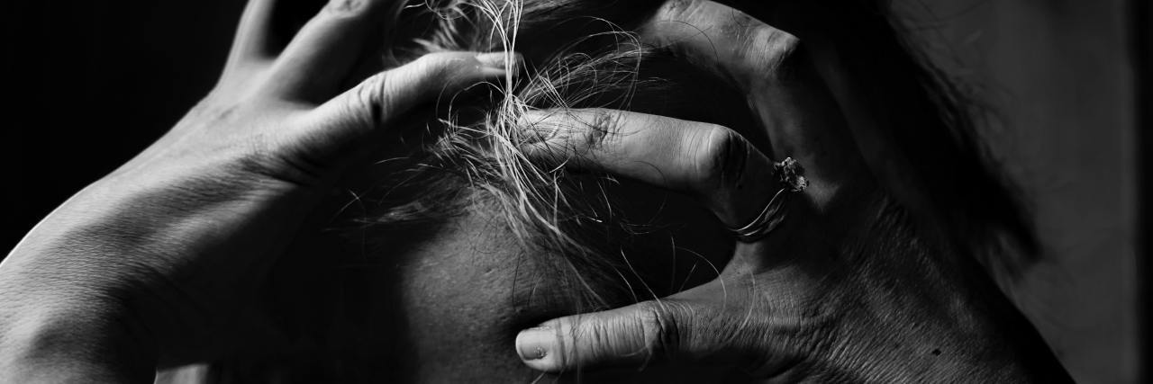 My Bipolar Disorder Is Not Your ‘B’ Word A closeup of a woman holding her hands over the top of her head. Black and white photo.