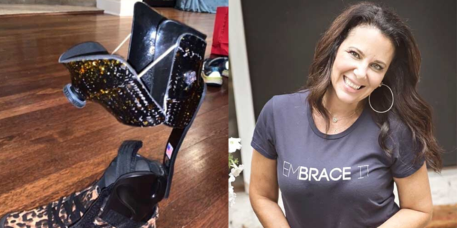 To Show or Not to Show Your Leg Braces in Life With a Disability Images of a glittery leg brace and the author wearing a shirt that says "EmBRACE It."