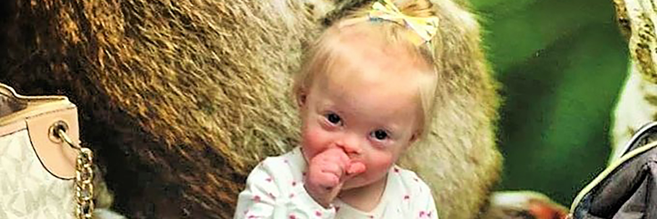 Top 5 Down Syndrome Myths Debunked Alice sucking her thumb.