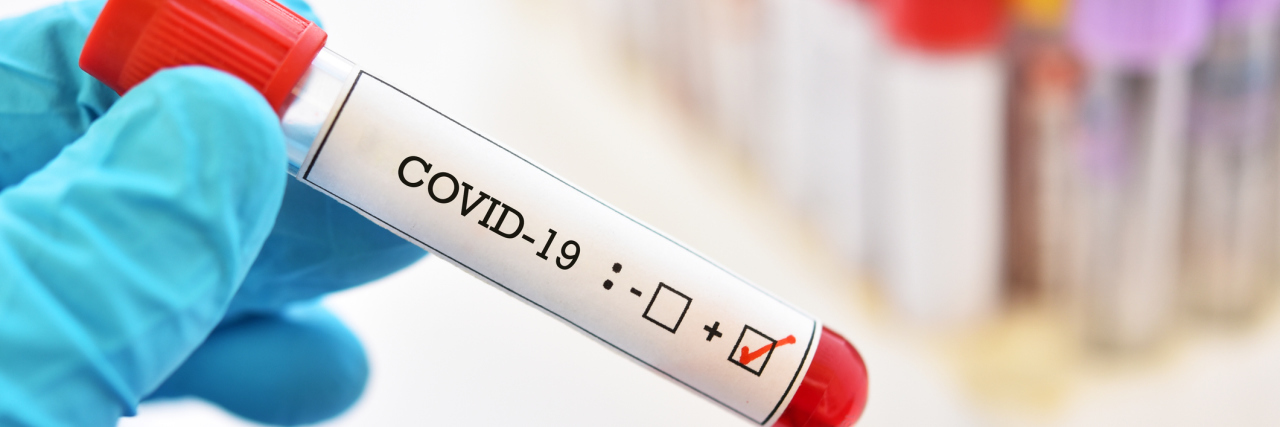 A Coronavirus Test May Now Be Available, but It Might Not Be Cheap Blood sample tube positive with COVID-19