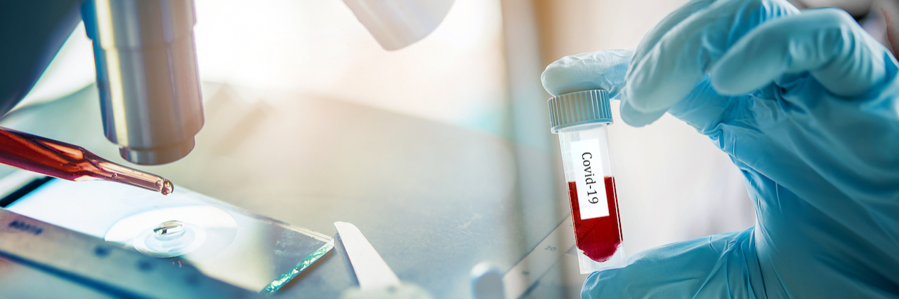 Can You Be Immune to COVID-19 and What Is Antibody Testing? Doctor holding blood test tube sample of coronavirus at laboratory with microscope