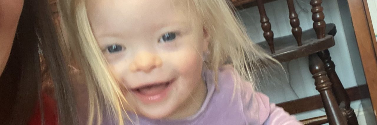 The Point 'More Alike Than Different' Misses About Down Syndrome Alice, a little girl with Down syndrome.