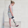 Callie wearing her prosthetic leg.