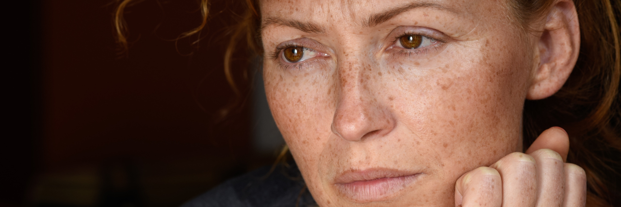 Letting Go of Guilt and Toxic Friends After a Brain Injury Sad woman with red hair.