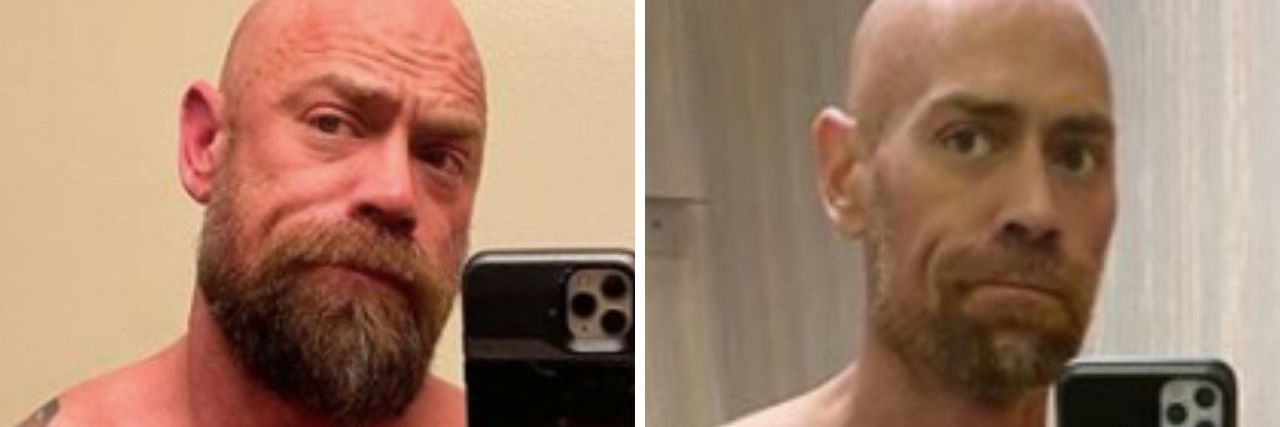 Mike Schultz before and after photos