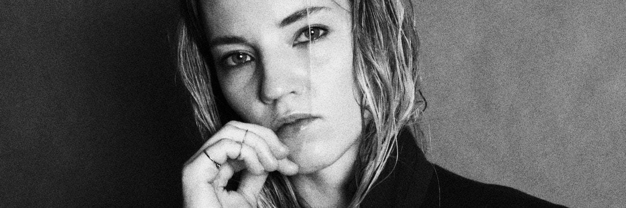 Facing and Accepting How Lupus Changes Your Life black and white photo of a woman