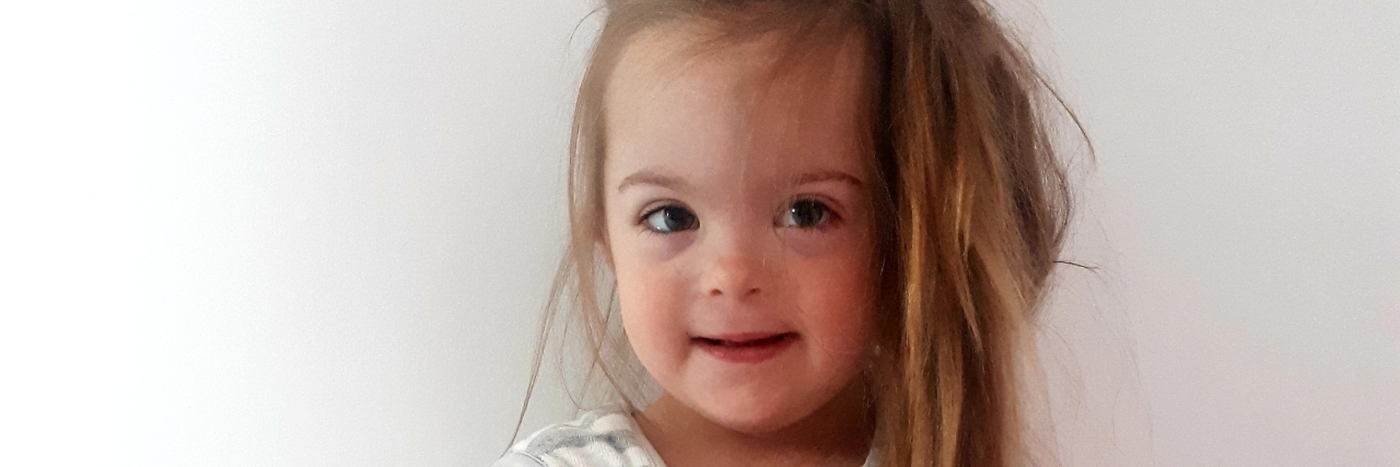 Parents of Children With Down Syndrome in the UK Need Support Betsy wearing a striped dress.