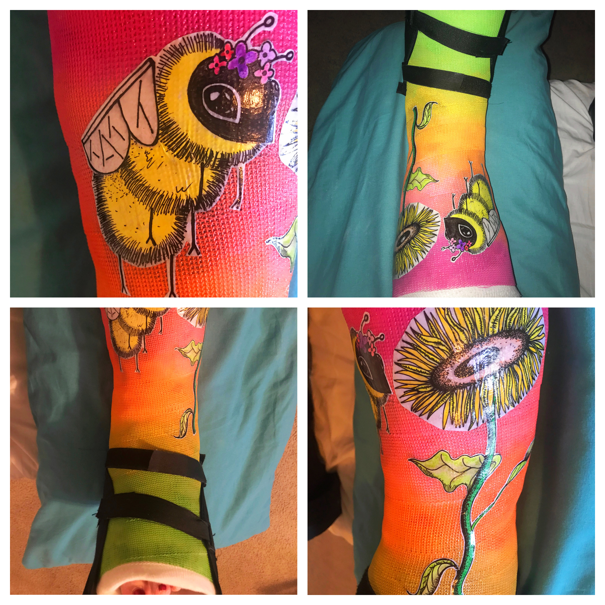 Cast decorated with flower and bumblebee.
