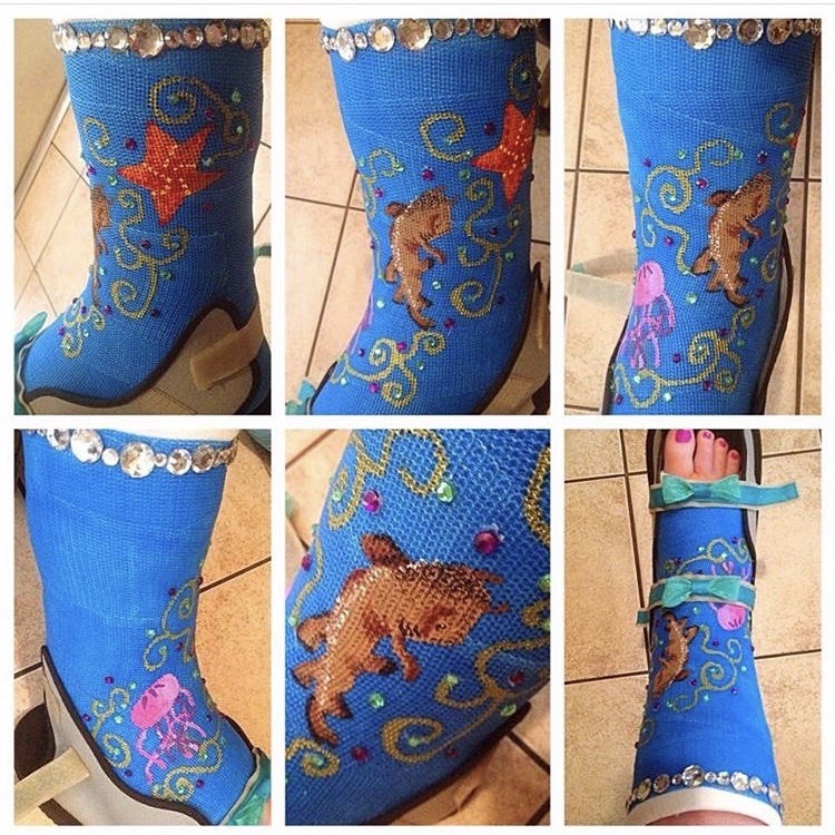 Katie's cast art with rhinestones and sharks.