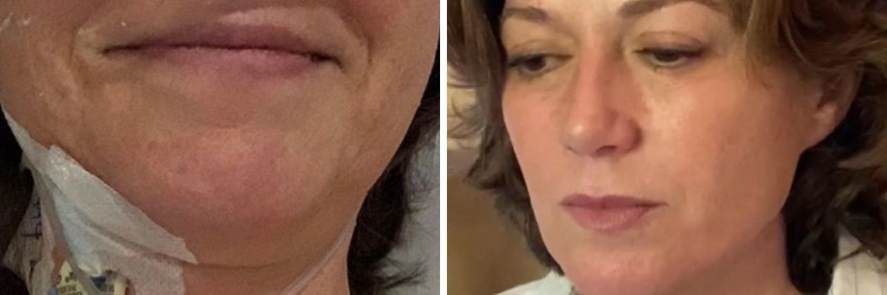 Amy Grant Shares Scar Photo After Emergency Open-Heart Surgery