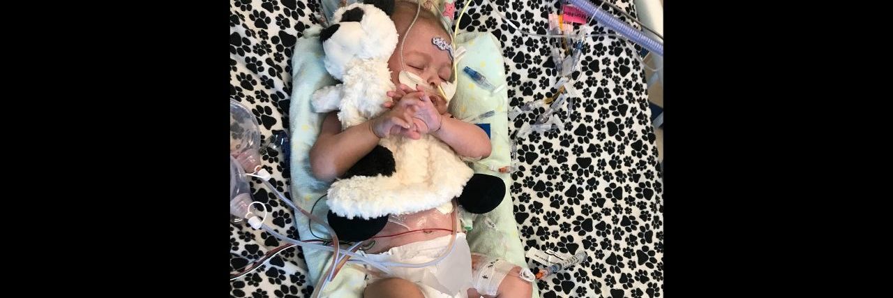 When Your New Child is Born With a Congenital Heart Defect A newborn baby lying in a hospital bed with wires and tubes.