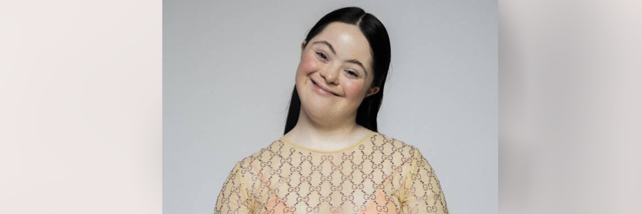 Model with Down Syndrome Stuns in Gucci's Vogue Italia Campaign Ellie Goldstein modeling for Gucci's Vogue Italia campaign