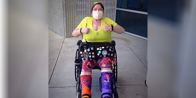 Katie wearing two painted leg casts.