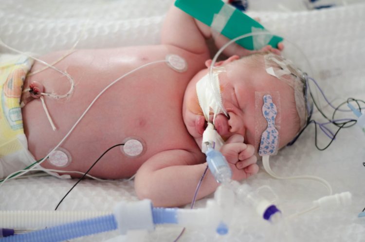A baby in the neonatal intensive care unit