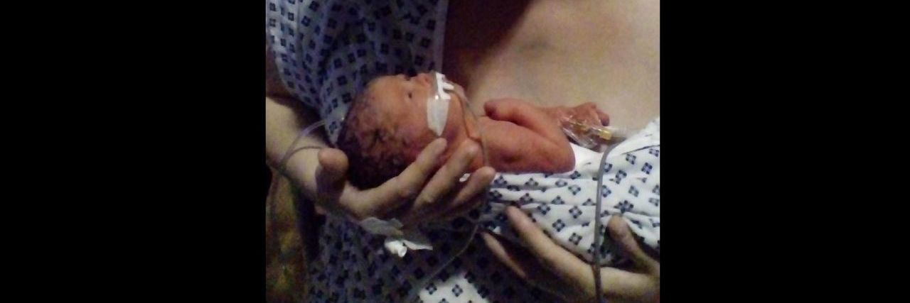 Standing Against Prejudice Towards My Unborn Baby With Down Syndrome A mom cradling her newborn baby in the intensive care unit