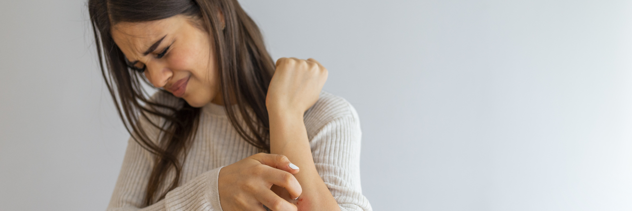 7 Misconceptions About Hidradenitis Suppurativa Young woman scratching arm from having itching on white background.