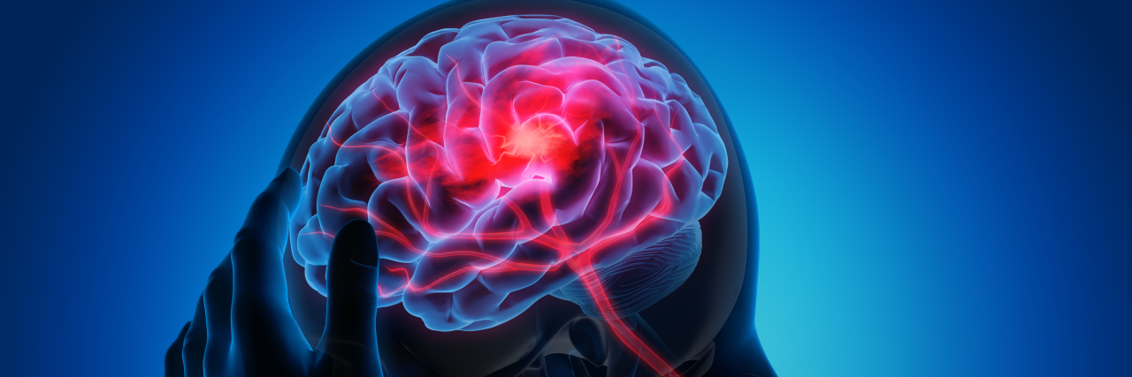 Deep Brain Stimulation to Reduce Self-Injury in Autism Medical illustration of a brain.